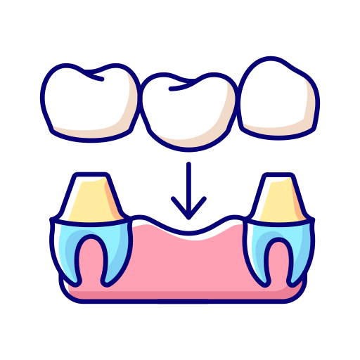 Crown and Bridges