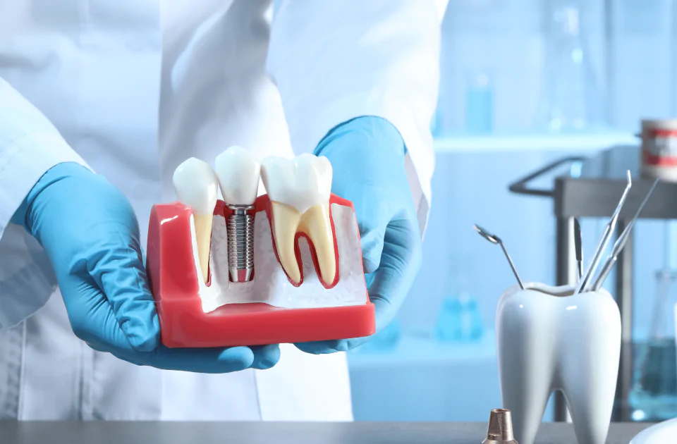 Dental Implant Treatment