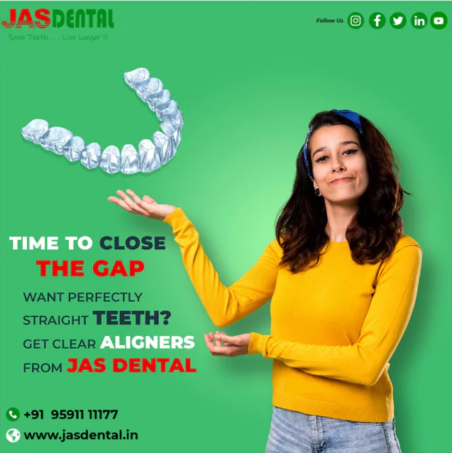 Invisible Aligners Treatment in Bangalore