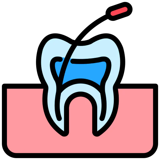 Root Canal