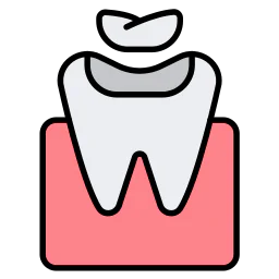 tooth-color-filling